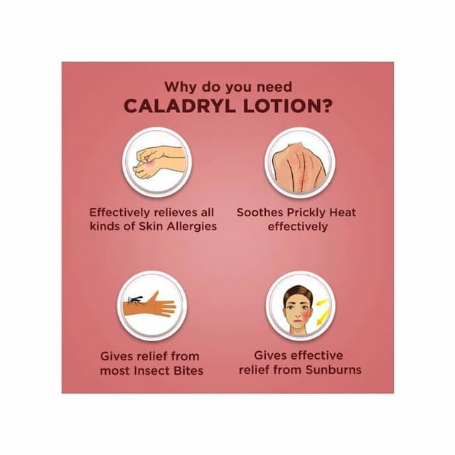 Caladryl Skin Allergy Expert Calamine Lotion- Skin Soothing Solution - 60 Ml