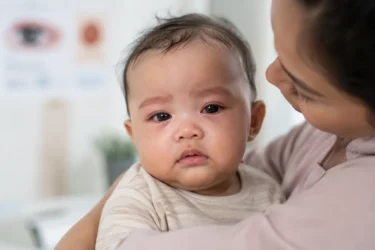 allergic conjunctivitis in infants 