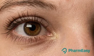 Home Remedies to Keep Dark Circles Away
