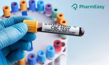 CBC Test