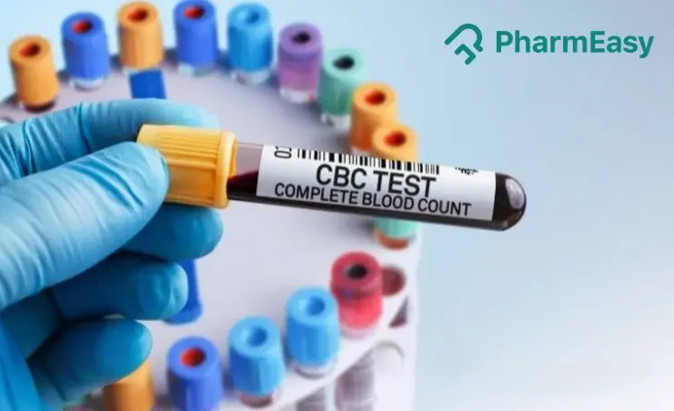 CBC Test