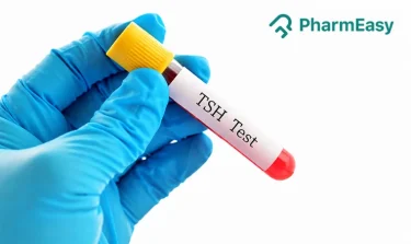 TSH Test