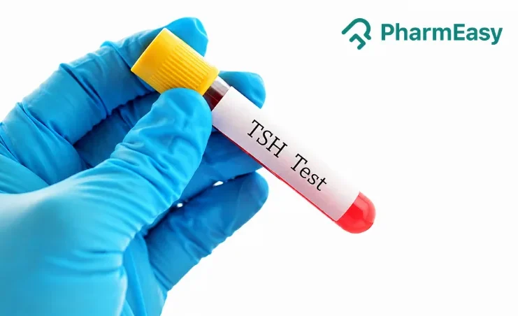 TSH Test