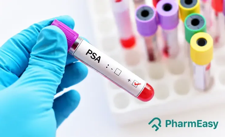 psa test