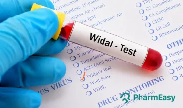 widal test