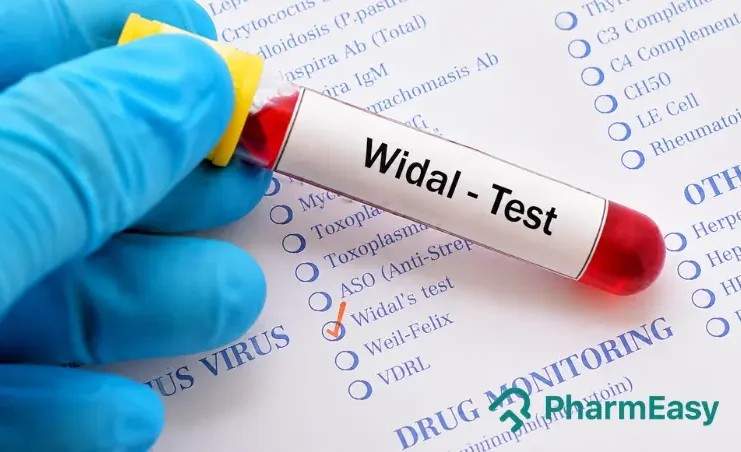 widal test