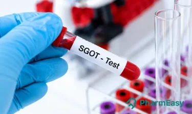 SGOT Test