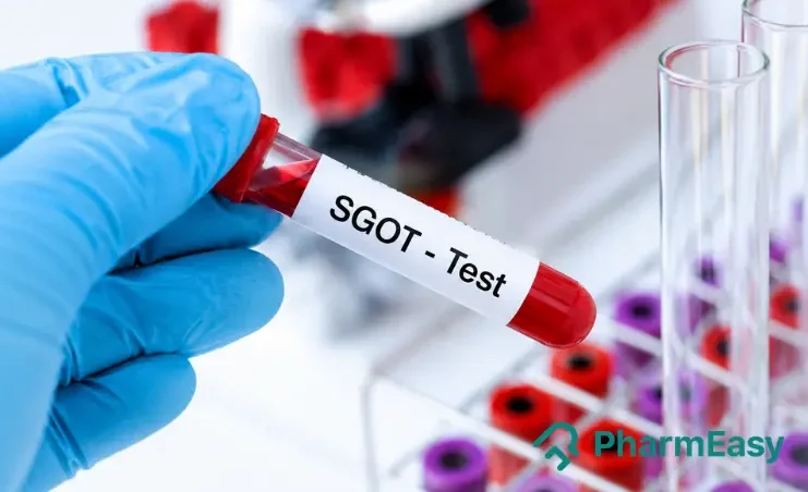 SGOT Test