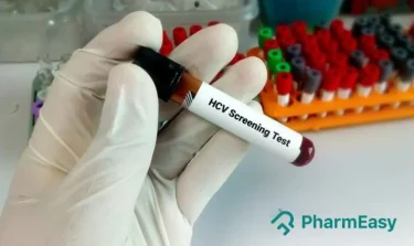 HCV Test