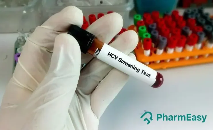 HCV Test
