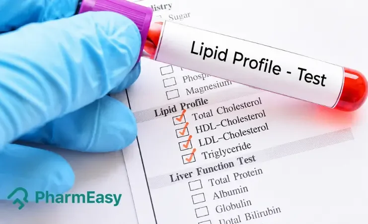 Lipid Profile