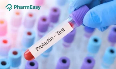 Prolactin Test