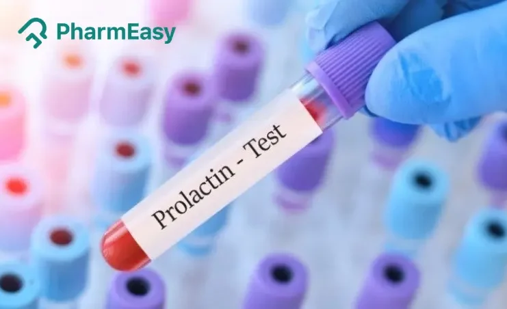 Prolactin Test