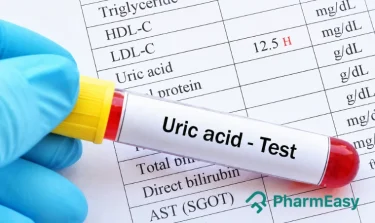 Uric Acid Test
