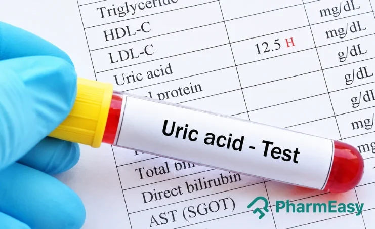Uric Acid Test