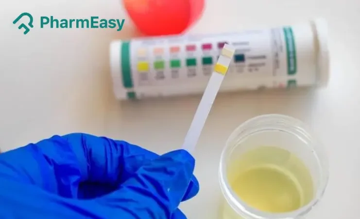 Urine Culture Test
