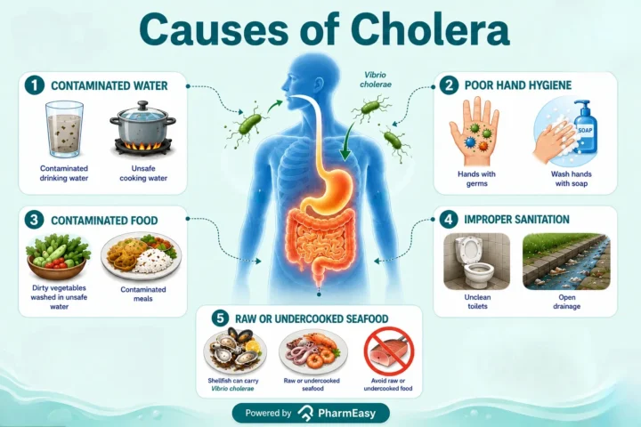 cholera