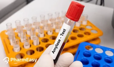 amylase test