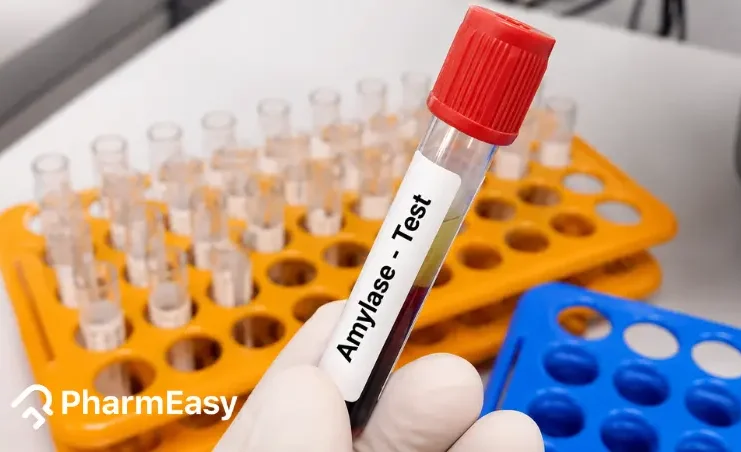 amylase test