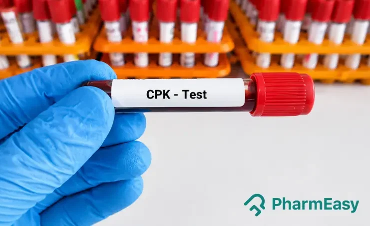ckp test
