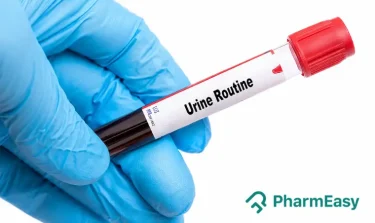 urine routine test