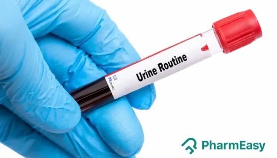 urine routine test