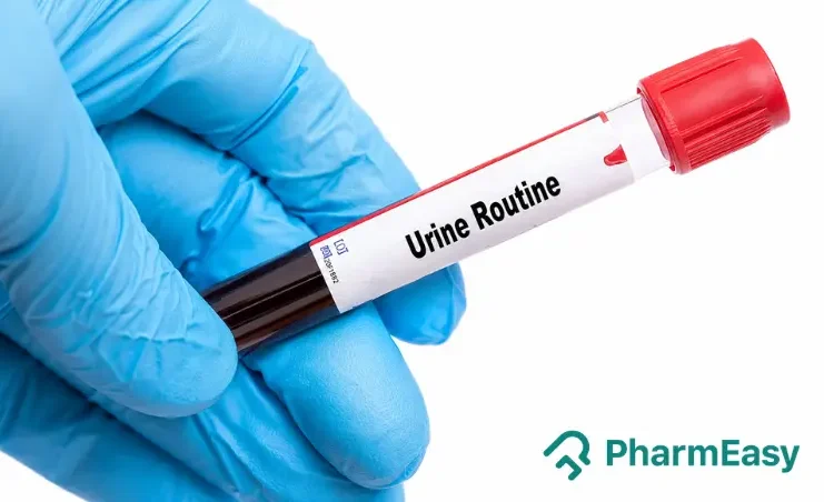 urine routine test