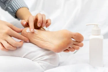 applying antiperspirants on feet