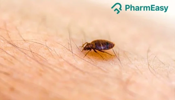 bed bug bites