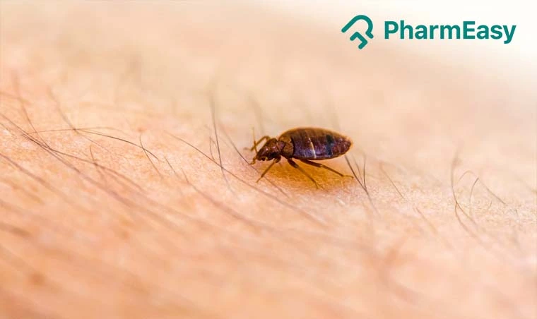 Bed Bug Bites: Causes, Symptoms, Treatment & More!