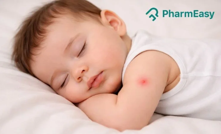 mosquito bites in babies