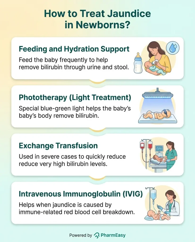 How to Treat Jaundice in Newborns?