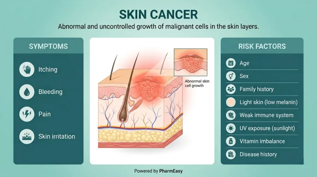 skin cancer