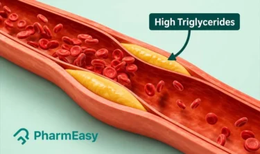 High Triglycerides: Causes, Symptoms, Diagnosis & How to Reduce It