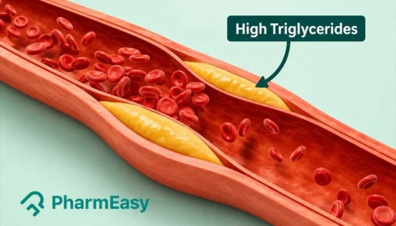 High Triglycerides: Causes, Symptoms, Diagnosis & How to Reduce It