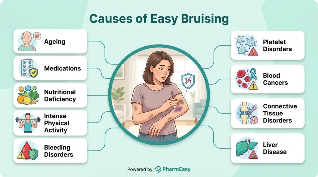 Causes of Easy Bruising