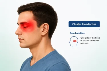 Cluster Headaches