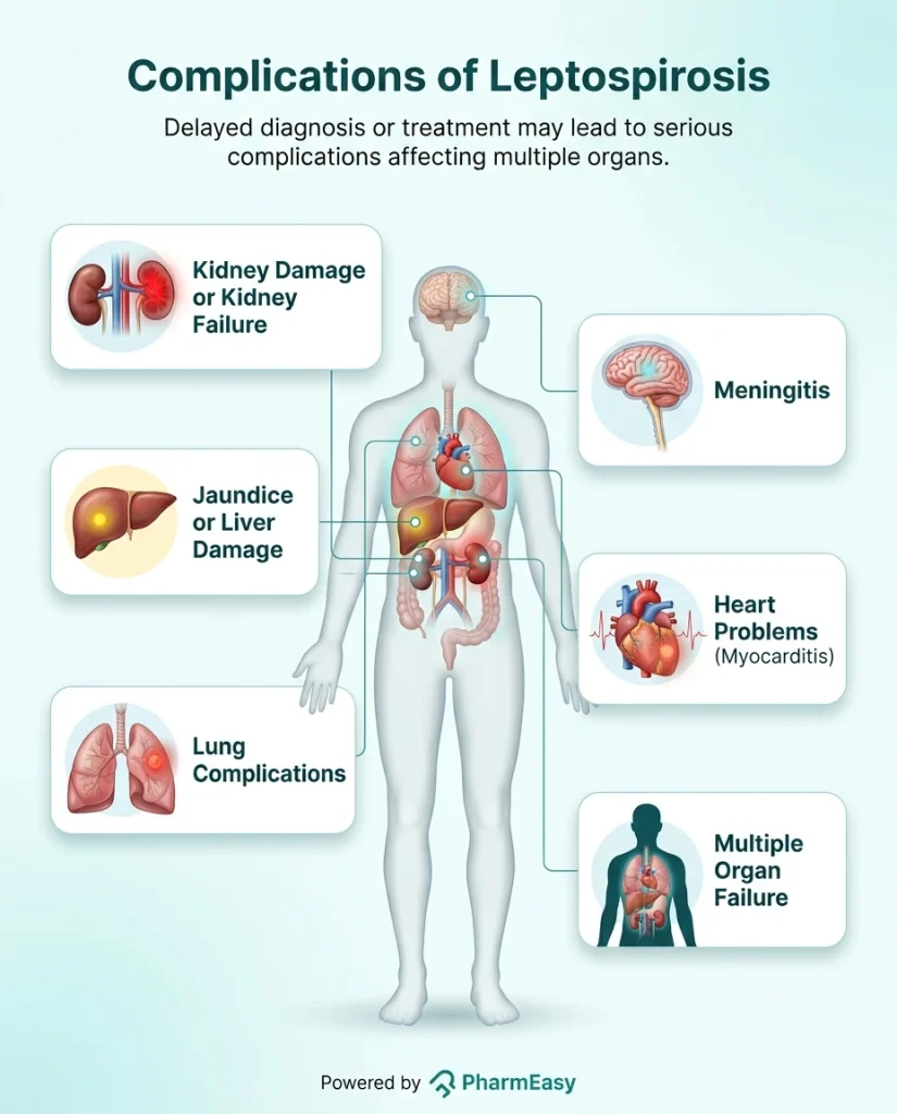 Complications of Leptospirosis