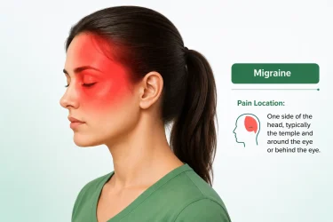 Migraine
