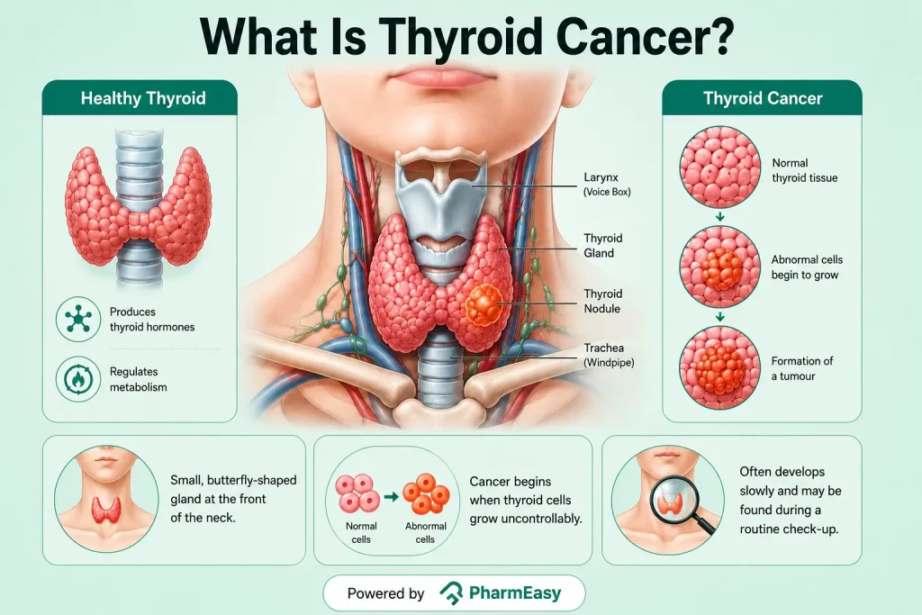 what is thyroid cancer