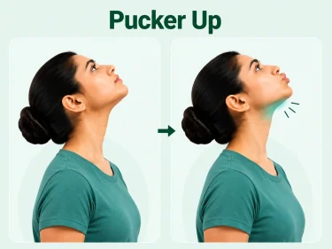 pucker up