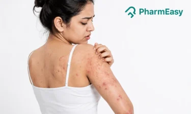 Dermatitis Herpetiformis