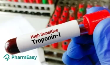 High-Sensitivity Troponin I (hs-Trop I) Test