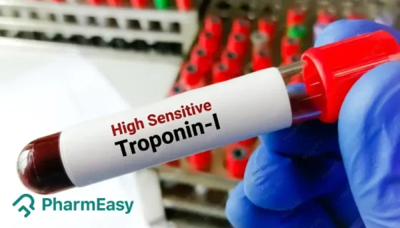 High-Sensitivity Troponin I (hs-Trop I) Test