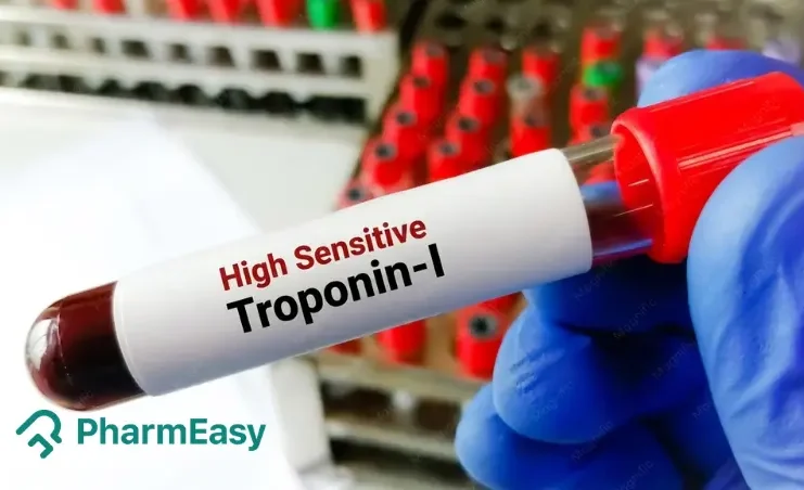 High-Sensitivity Troponin I (hs-Trop I) Test