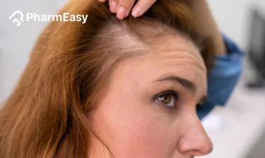 dht hair loss