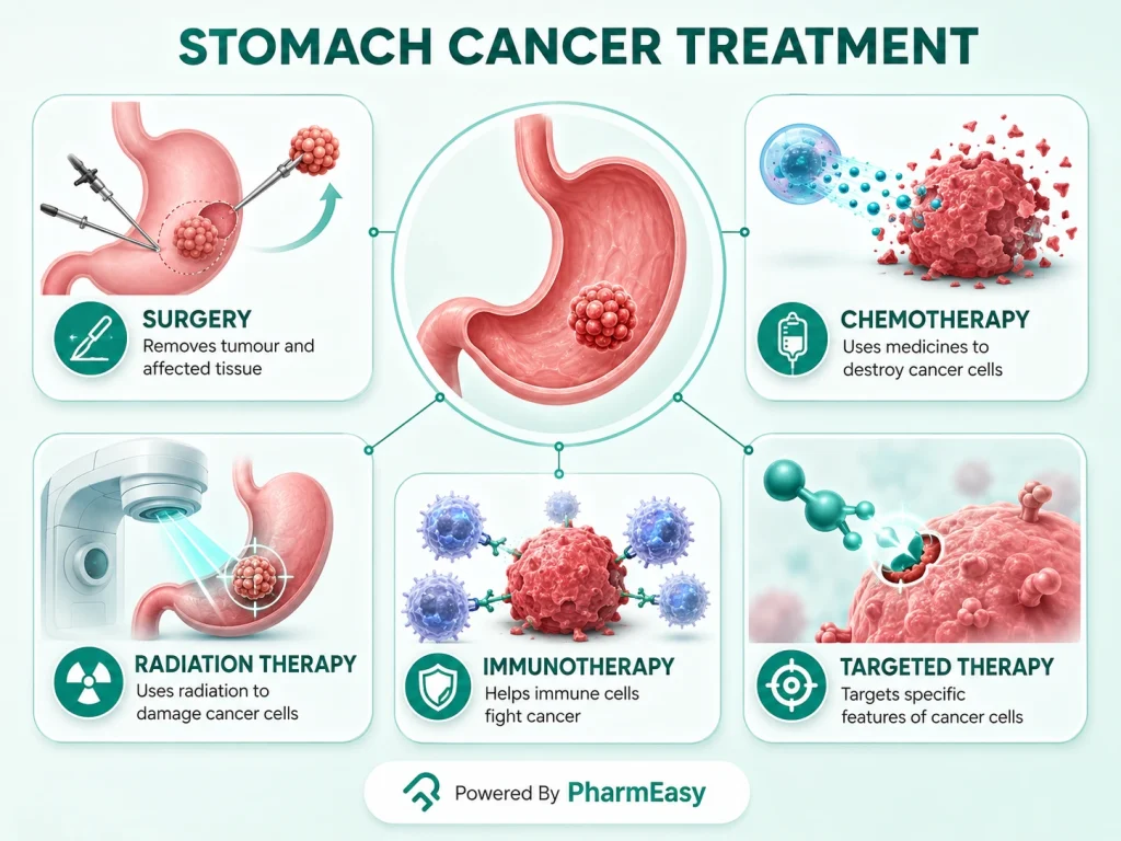 Stomach Cancer Treatment