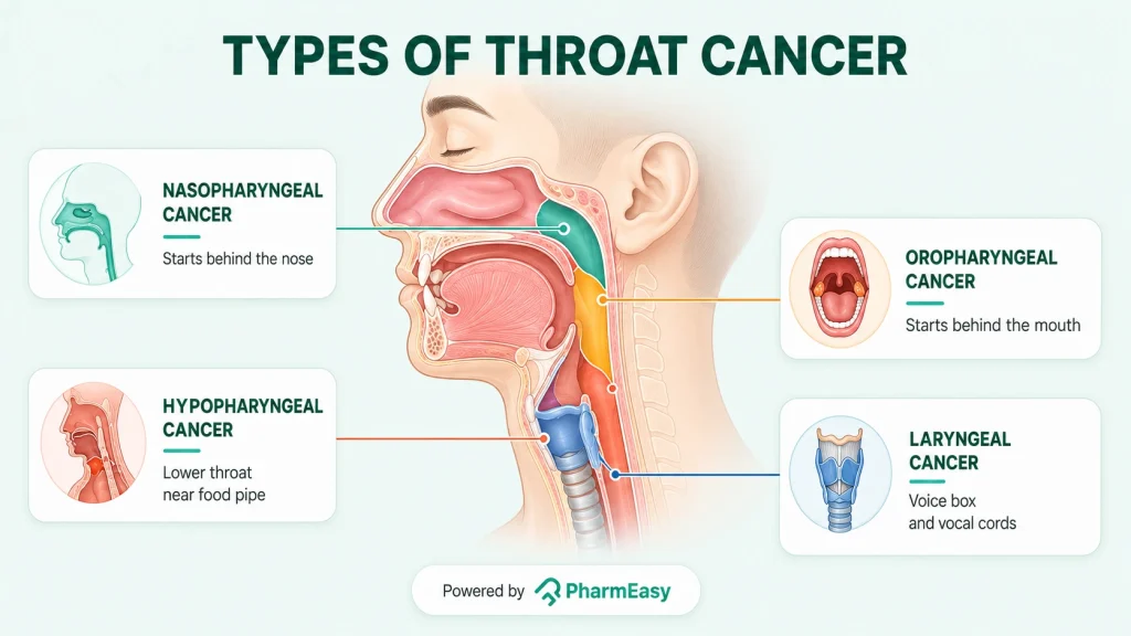 types of throat cancer