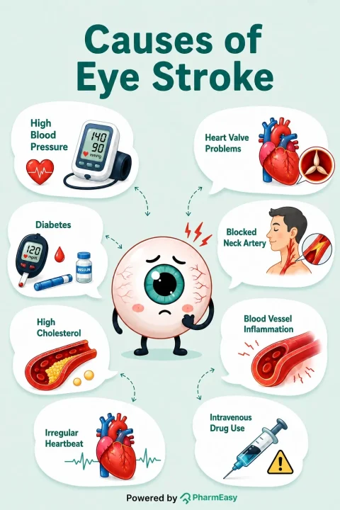 causes of eye stroke