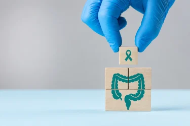 colorectal cancer